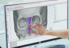 Cấy ghép silicon tùy chỉnh 3D FITme  sản xuất bằng phân tích CT và máy in 3D tiên tiến của Formlab, 