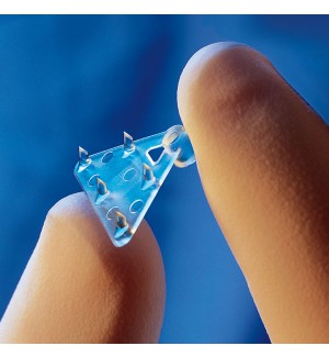 Phẫu Thuật Treo Chân Mày Nội Soi Endotine-Biobsorb Fixtine