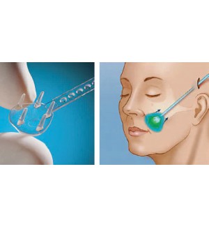 Phẫu Thuật Treo Chân Mày Nội Soi Endotine-Biobsorb Fixtine
