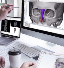 Phần mềm sử dụng FITme Software