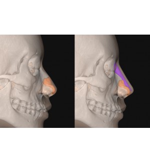 Phần mềm sử dụng FITme Software